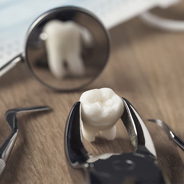 canyon state dental chandler az patient education when is tooth extraction necessary