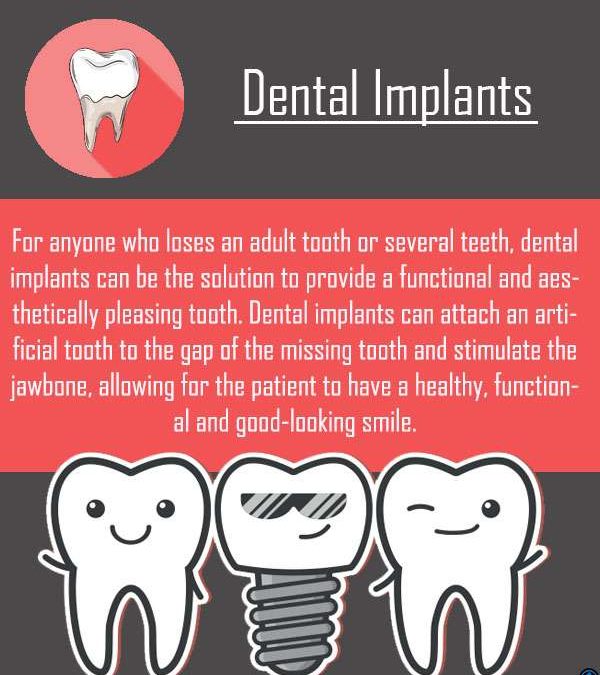 Dental Implants are The Solution For Missing Teeth