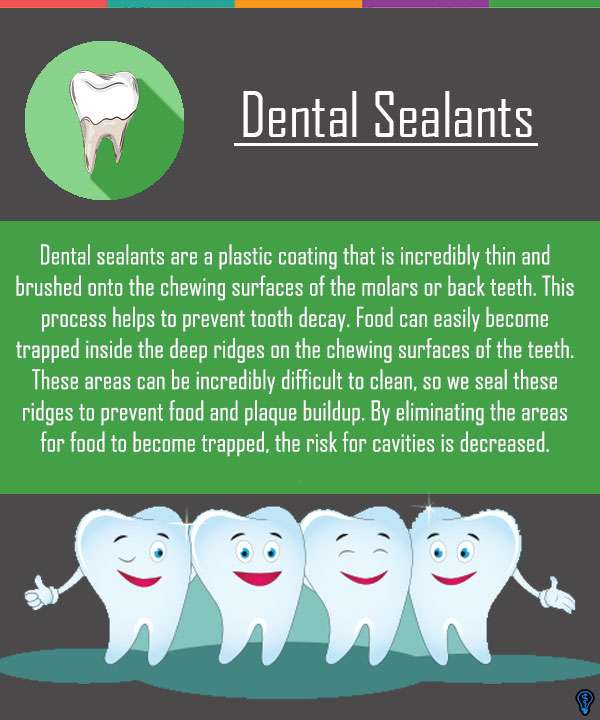 dental sealants sp0144