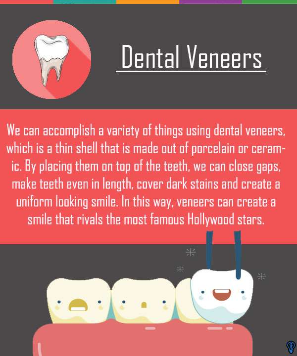 Dental Veneers and Dental Laminates Chandler, AZ