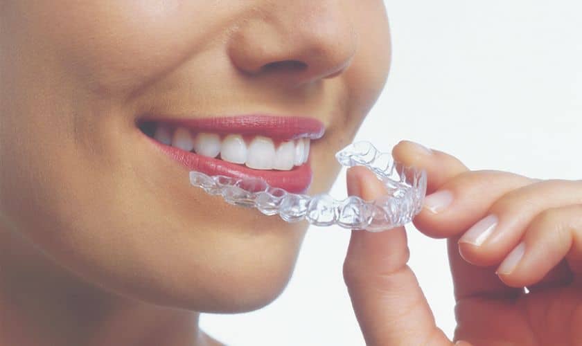 Reasons To Opt For Invisalign