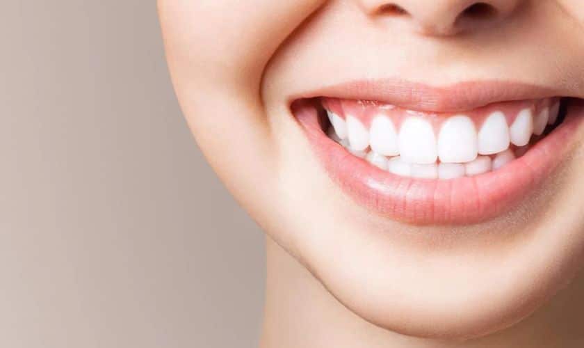Why Cavities Should be Fixed Before Teeth Whitening?