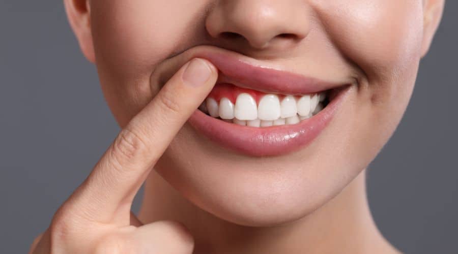 Treating Gum Disease at Home: A Guide Without Visiting a Dentist