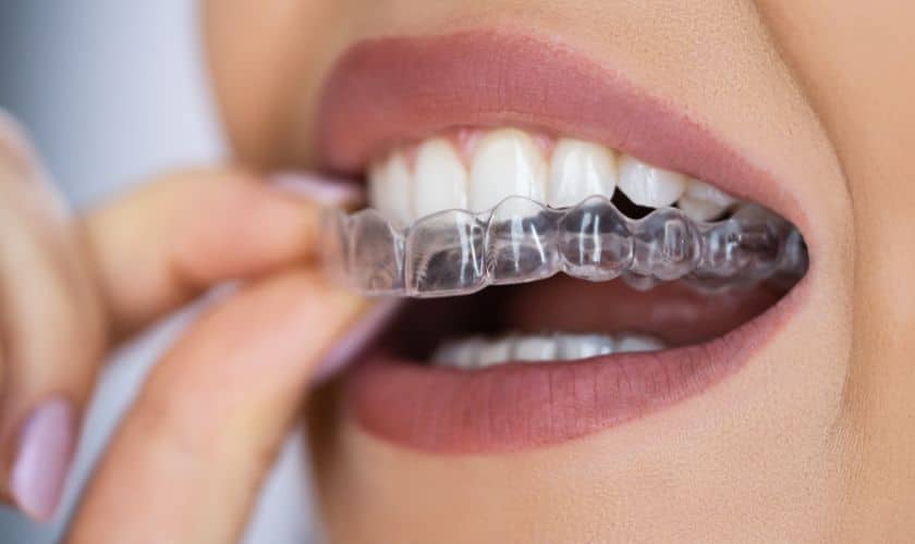 Top 7 Tips to Help You Maintain Your Invisalign Clear Aligners