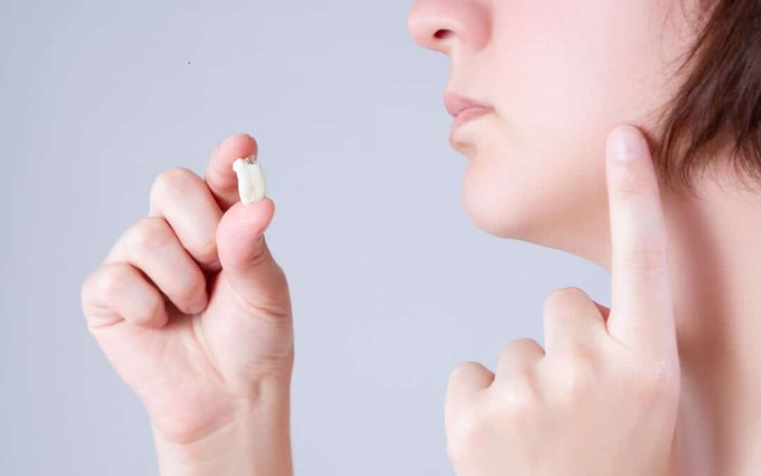 How Painful Is Wisdom Teeth Removal?