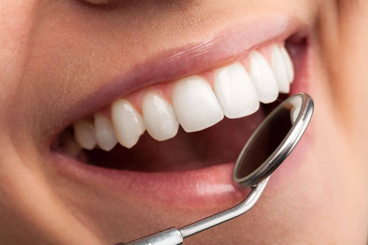 cosmetic bonding chandler