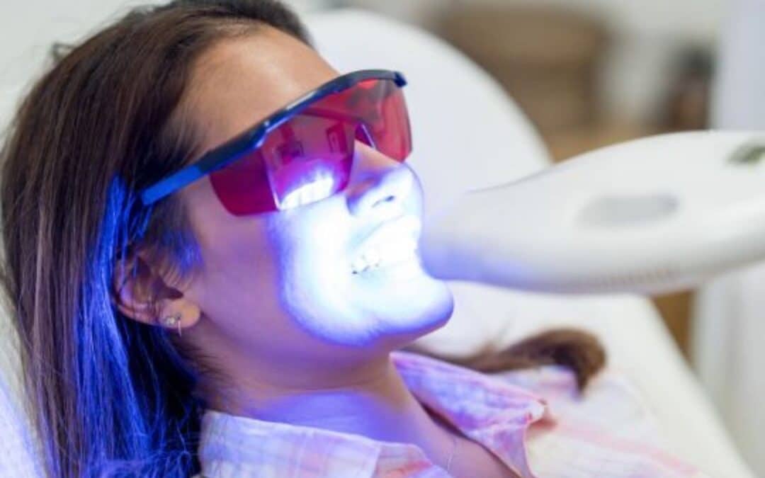 Can Teeth Whitening Damage Your Enamel? What You Need to Know