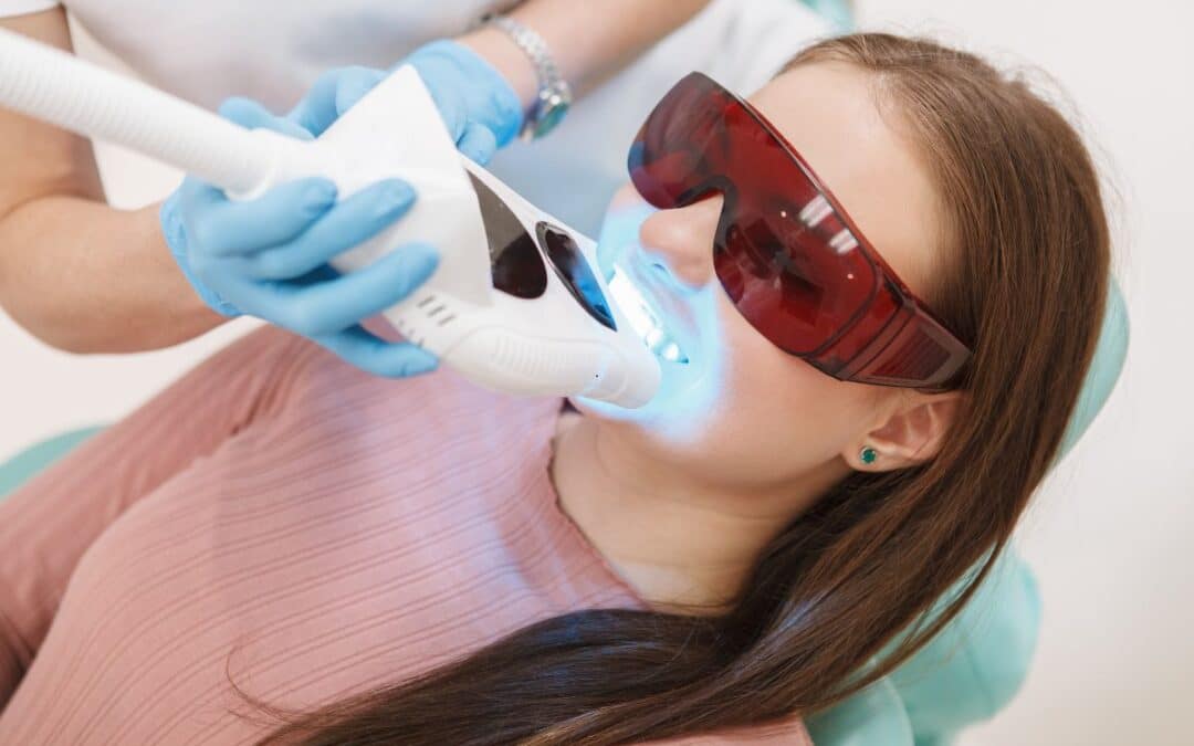 Top Benefits of Professional Teeth Whitening