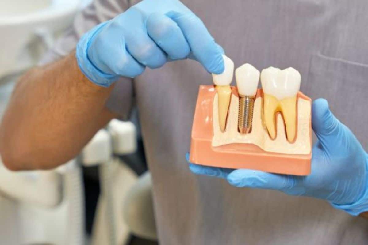 dental implants chandler