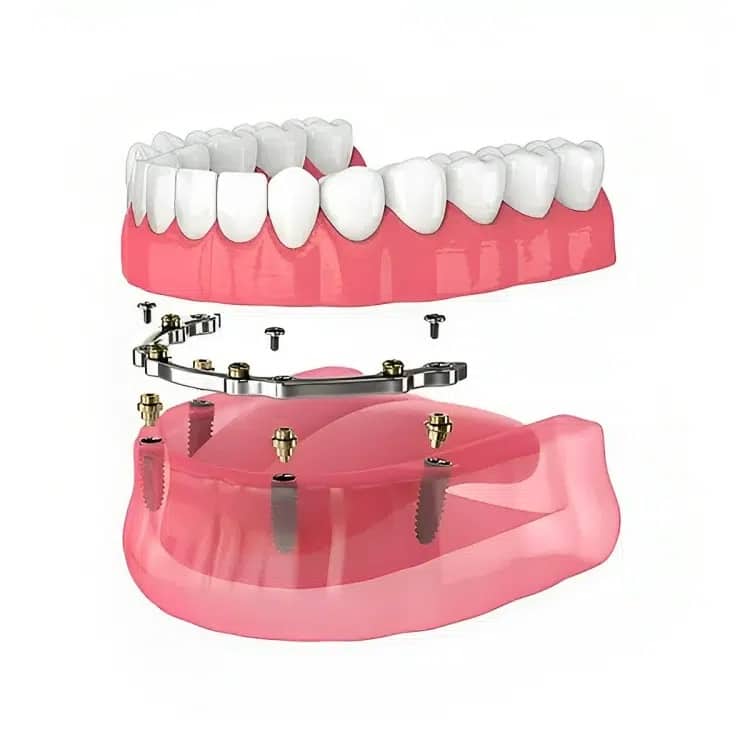 dentures chandler AZ