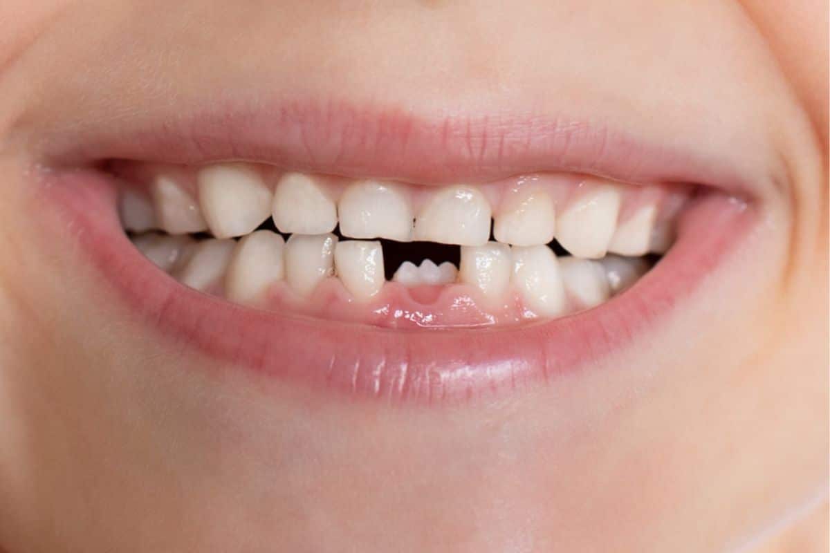 emergency dentist in Chandler