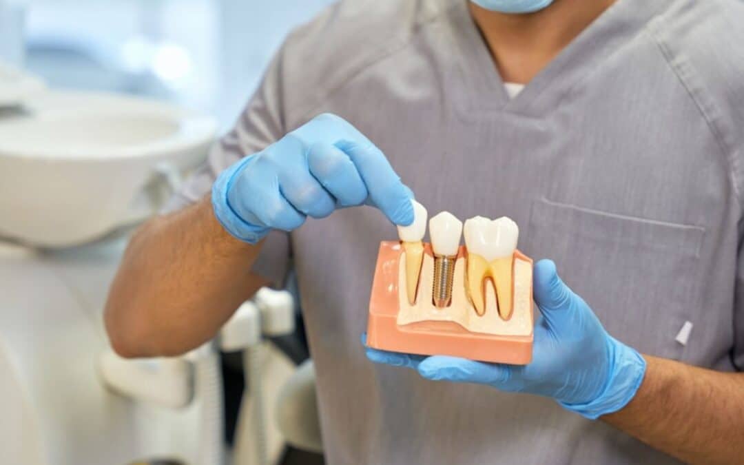 Restore Your Smile with Confidence: Why Chandler Patients Choose Dental Implants