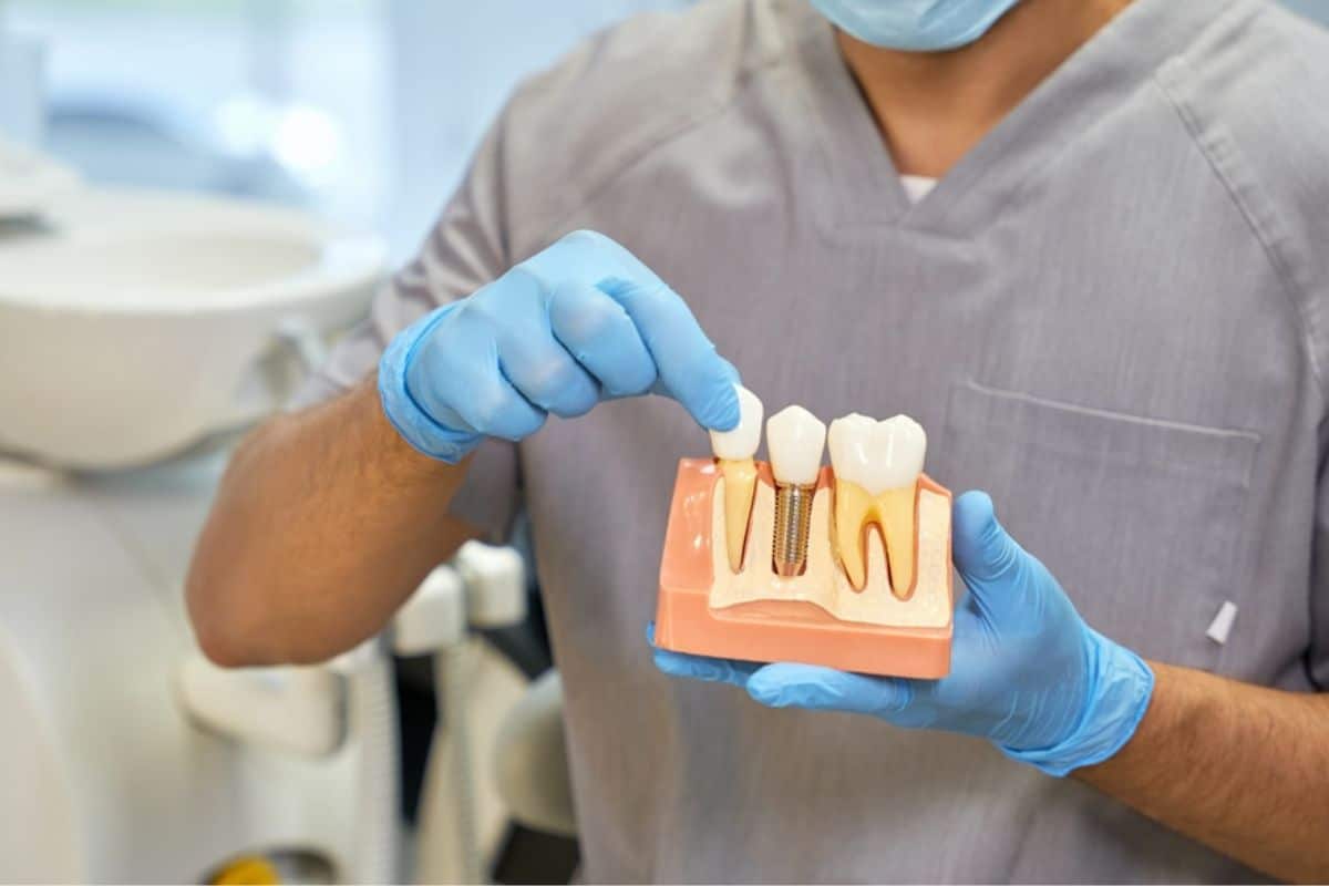 Dental implants chandler