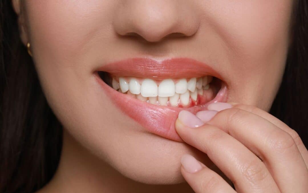 Signs That Mean It’s Time to See Your Dentist