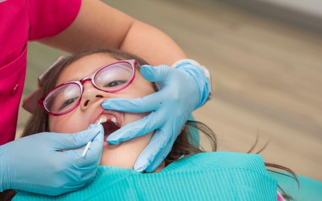 What to Know About Eating After Fluoride Treatment