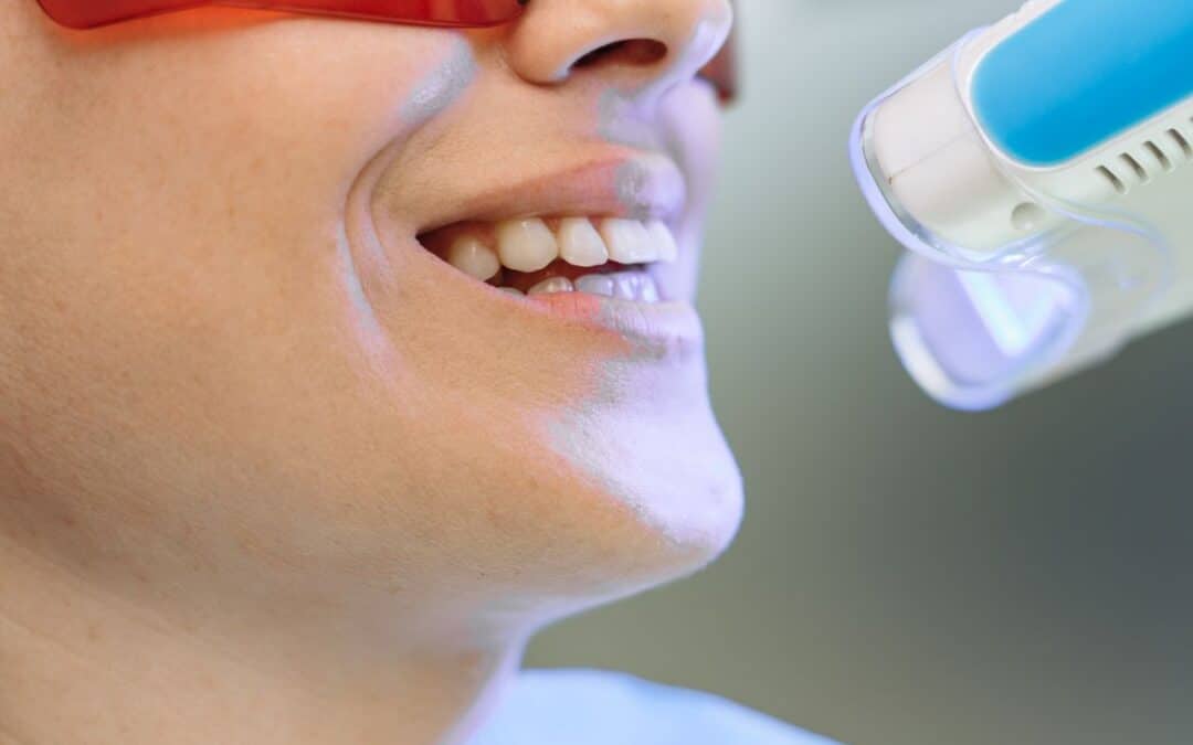 Say Goodbye to Yellow Teeth: Expert Whitening Tips