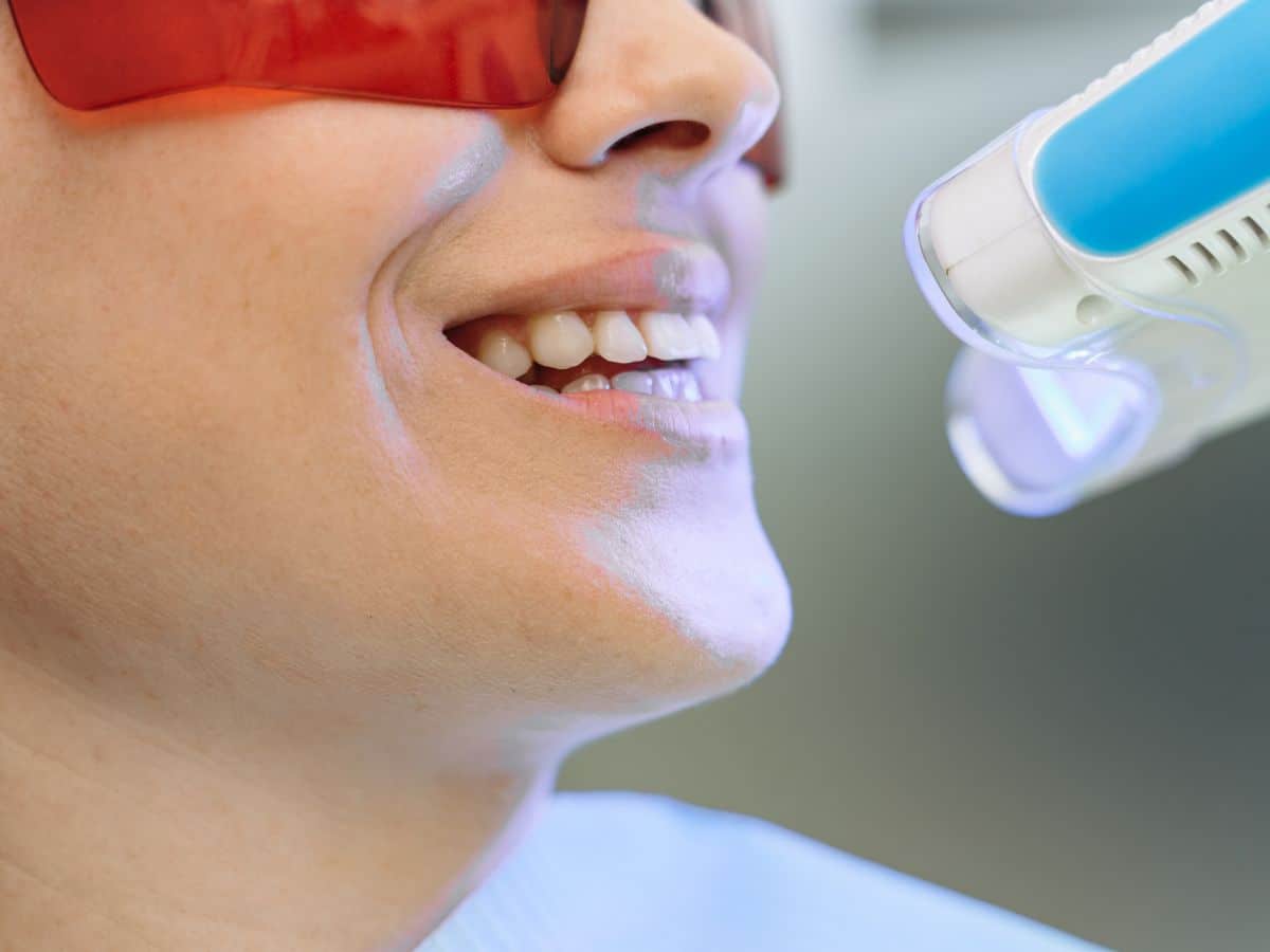 teeth whitening Chandler