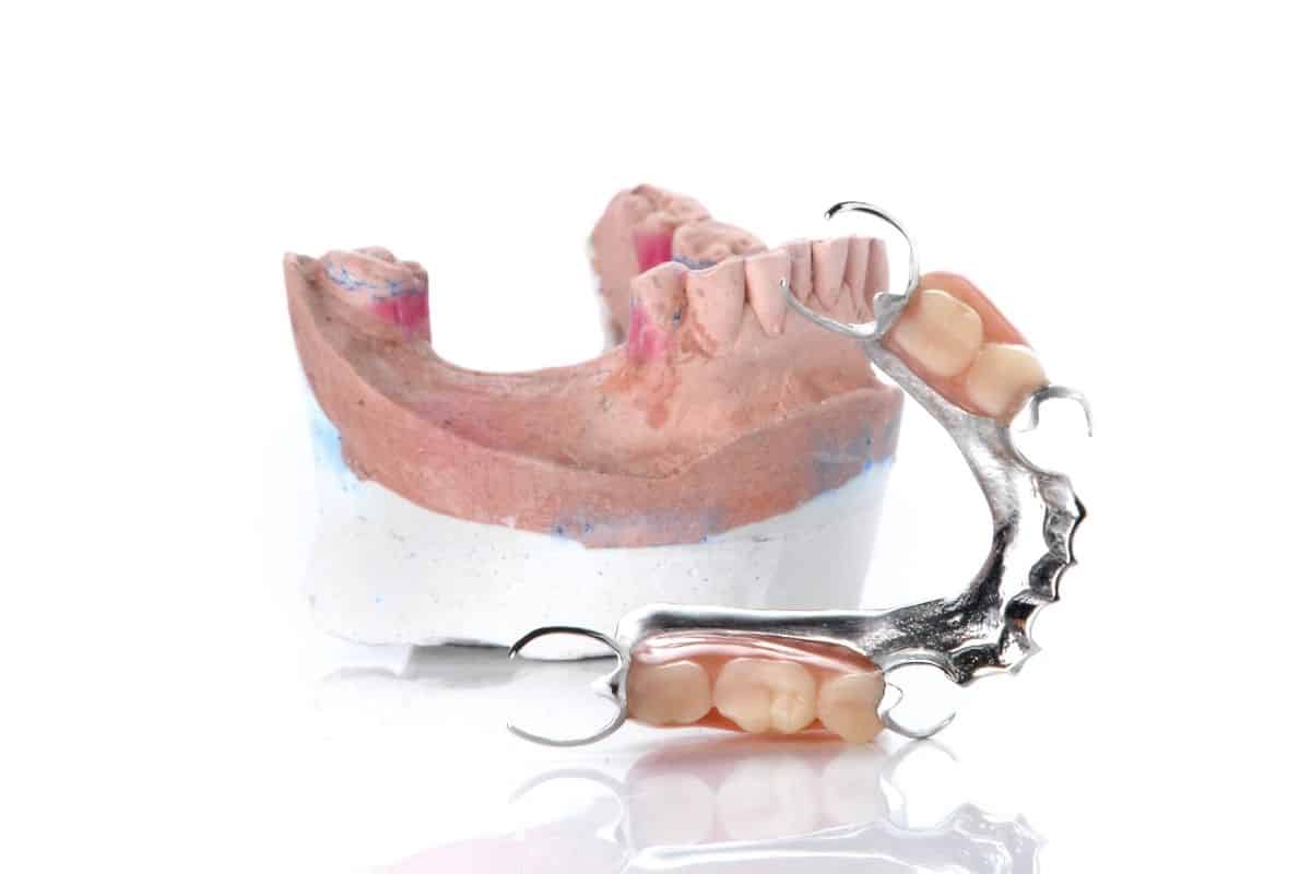 _partial dentures partial dentures